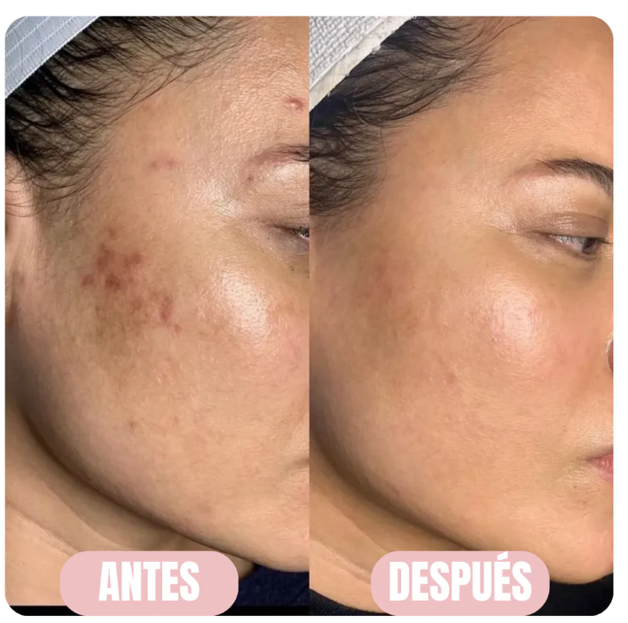 Mascarilla de colageno| 75ml